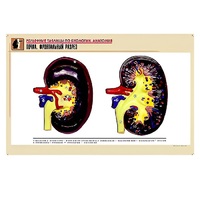 Рельефная таблица "Почка. Фронтальный разрез" (формат А1, матовое ламинир.) - «globural.ru» - Севастополь